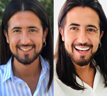 Não havia necessidade! Ex-concorrente da ‘Casa dos Segredos’ muda o sorriso... e ouve aquilo que não quer