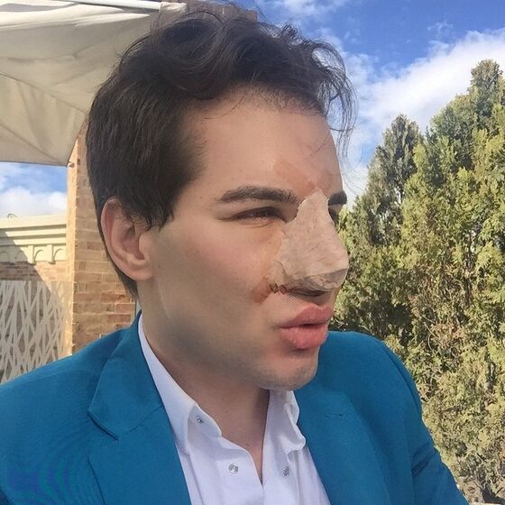 Ken Humano, Rodrigo Alves