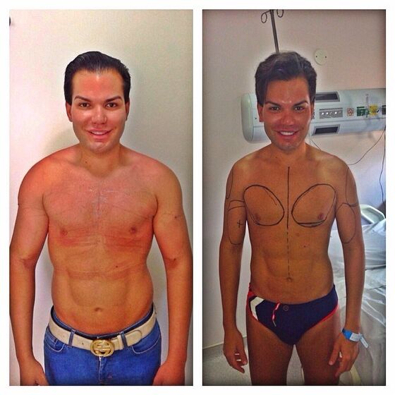 Ken Humano, Rodrigo Alves