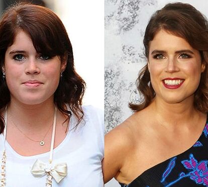 Perda de peso da princesa Eugenie está a criar polémica. Terão sido comprimidos 'milagrosos'?