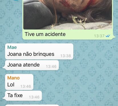 Atriz Joana Ribeiro assusta a família ao revelar imagem de acidente brutal que 'sofreu'