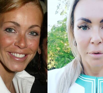Já viu o que mudou Elsa Raposo em 15 anos? Ex-modelo parece ter feito nova operação