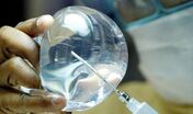 Silicone, Implante, Cirurgia plástica
