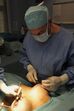 Silicone, Implante, Cirurgia plástica