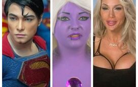 Como eles ficaram! As maiores aberrações das cirurgias plásticas