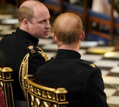 Principe Harry está a ficar calvo como o irmão