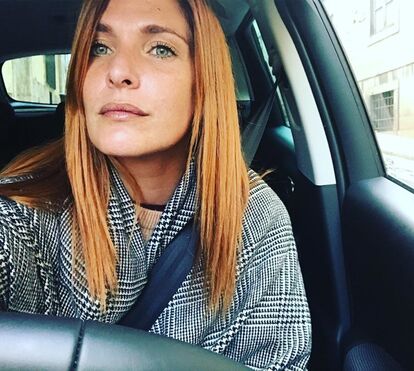 Que azar! Acidente de Inês Castel-Branco mais grave do que parecia. Atriz mostra consequências