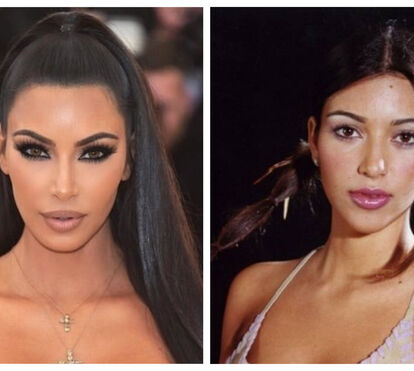Mulher sofre! Kim Kardashian foi operada 5 vezes para tratar as mazelas da gravidez e do parto