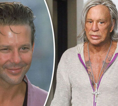 Meu Deus, que transformação! Mickey Rourke está completamente desfigurado e parece um boneco 