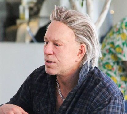 Impressionante a cara de Mickey Rourke, depois de anos e anos de operações estéticas
