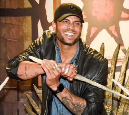 'Dentes de prata'! A estranha moda que conquistou o namorado de Rita Pereira