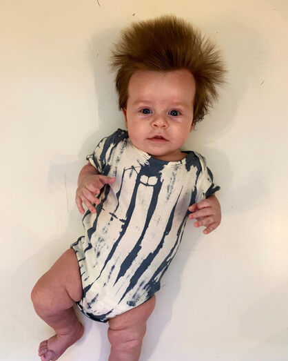 bebé com cabelo enorme, austrália