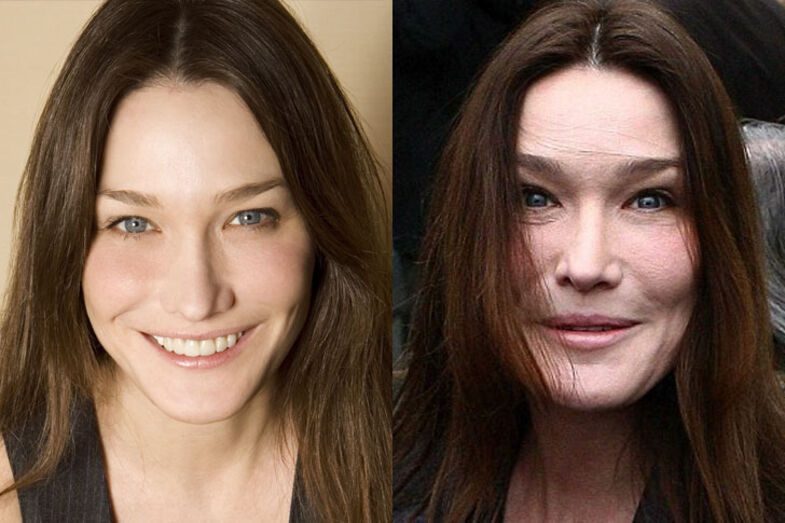 Carla Bruni