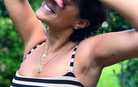 A quebrar tabus! Sofia Ribeiro mostra como ficou cicatriz da cirurgia na mama