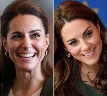 Novo vício da duquesa? Kate Middleton 'ama um pouco de botox', garante especialista
