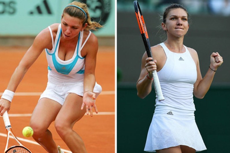 O antes e depois da tenista que fez uma mamoplastia para ser n1 do mundo 