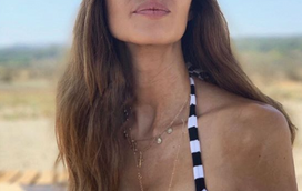 Preocupante! Sara Carbonero surge assustadoramente magra