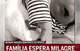 Família de bebé Rodrigo, que nasceu com malformações, espera um milagre