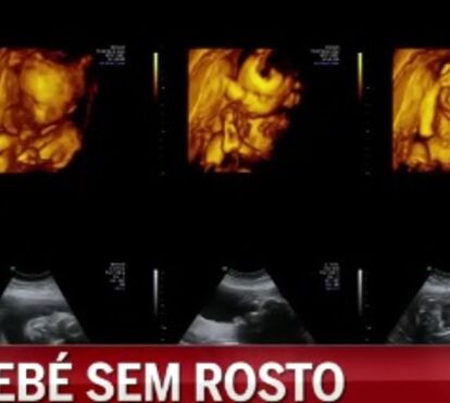 Bebé Rodrigo é vigiado pela mãe em permanência