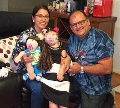 Um caso igual ao bebé Rodrigo! Menina que nasceu sem rosto sobreviveu e já tem 11 anos