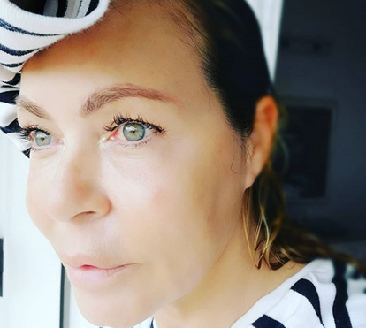 Viciada em plásticas? Elsa Raposo mostra o resultado de várias intervenções estéticas ao rosto
