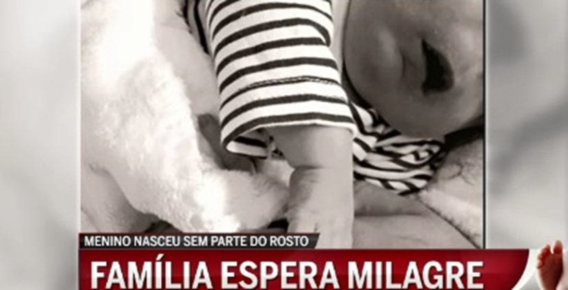 Milagre Especialistas Nao Conseguem Explicar Sobrevivencia De Rodrigo O Bebe Sem Rosto Nacional Flash