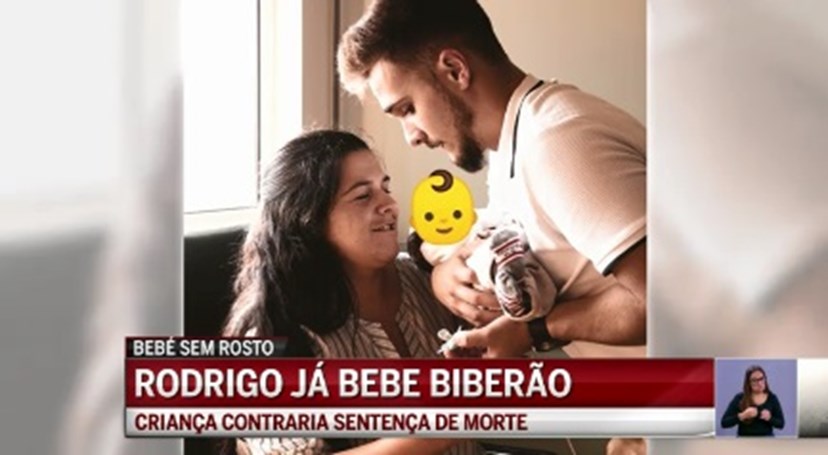 Milagre Especialistas Nao Conseguem Explicar Sobrevivencia De Rodrigo O Bebe Sem Rosto Nacional Flash