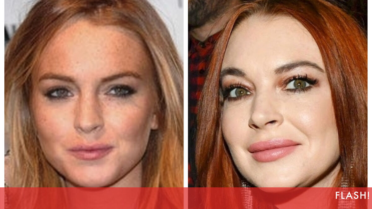 Depois do álcool e das drogas! Lindsay Lohan tem o vício do botox e das ...