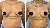 Blaya, Pedro Russo, separação, maminhas, operação plástica, cirurgia, maminhas novas