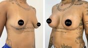 Blaya, Pedro Russo, separação, maminhas, operação plástica, cirurgia, maminhas novas
