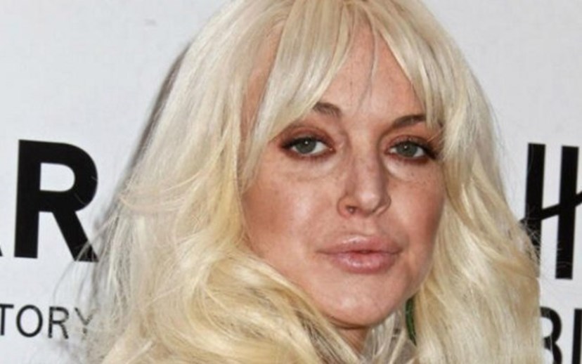 Depois do álcool e das drogas Lindsay Lohan tem o vício do botox e das plásticas Mundo FLASH