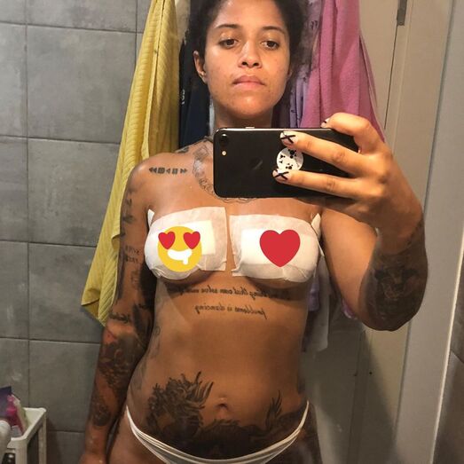Blaya, Pedro Russo, separação, maminhas, operação plástica, cirurgia, maminhas novas