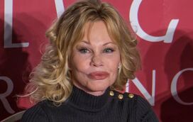 Faz tantas plásticas e está cada vez pior! Melanie Griffith voltou a mexer na cara 