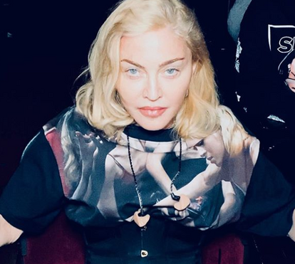Madonna está irreconhecível por causa das plásticas