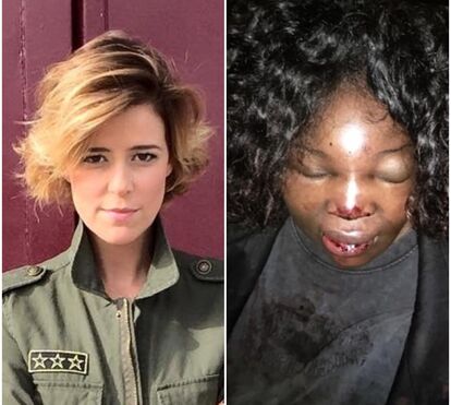 Leonor Poeiras em choque com cara da mulher que diz ter sido agredida por PSP