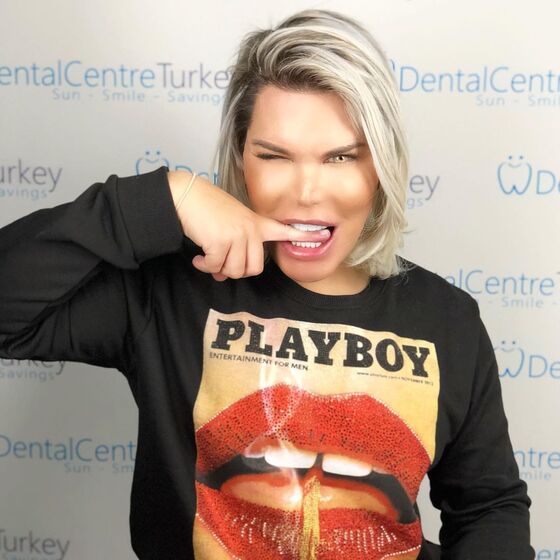 Rodrigo Alves, Ken Humano ou Barbie Humana