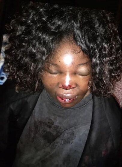 Cláudia Simões, mulher agredida