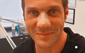 Pós-cirurgia! José Carlos Pereira exibe nariz retocado ao lado da namorada