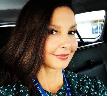 O que aconteceu com a cara dela?! Atriz Ashley Judd fala sobre o uso de botox com tratamento médico