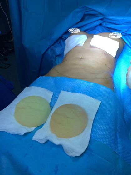 Érica Silva, casa dos segredos 4, tvi, cirurgia plástica, bloco operatório, José Moreira Martins