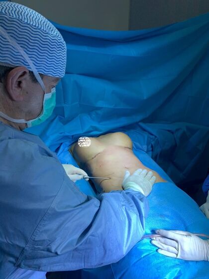 Érica Silva, casa dos segredos 4, tvi, cirurgia plástica, bloco operatório, José Moreira Martins