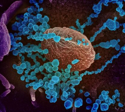 5 dias no plástico, 4 dias no papel. O tempo de vida do coronavírus nas superfícies