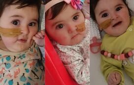 A bebé Matilde celebrou o primeiro aniversário. Veja como cresceu a bebé que recebeu o medicamento mais caro do mundo