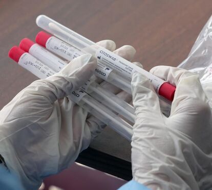 Coronavírus: Mais 323 infetados e seis mortos nas últimas 24 horas