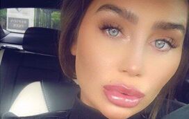 Lauren Goodger acusada de "embelezar" fotografia de infância