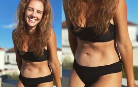 Marta Andrino revela drama com o corpo e as gravidezes: "ganhei uma hérnia umbilical e  muitas estrias ao seu redor"