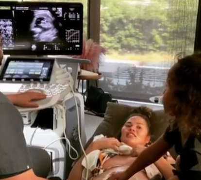 Filha de John Legend e Chrissy Teigen faz ecografia à mãe