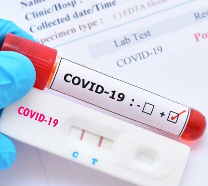 Sexta feira negra! Portugal com mais 6.653 infeções e 69 mortes por Covid-19