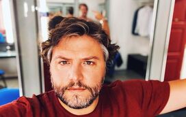 Incrível! A dolorosa transformação de César Mourão para a série 'Esperança' 
