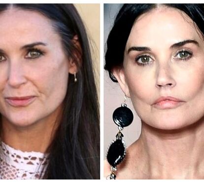 O que se passa aqui?! Demi Moore desfila para a Fendi... mas está a ser acusada de ter exagerado nas cirurgias plásticas